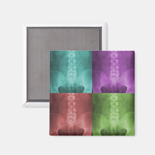 Digitale röntgenkunstmagneet magneet (Voorkant / Achterkant)