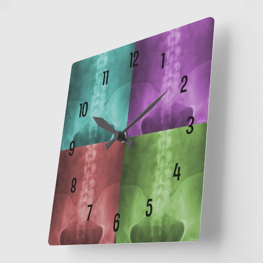 Digitale röntgenwandklok vierkante klok (Hoek)