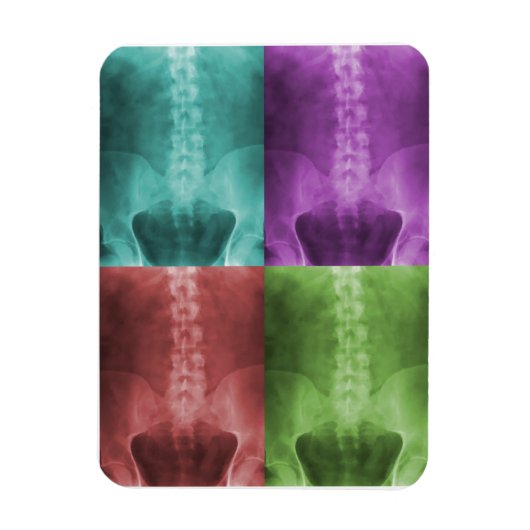 Digitale X-Ray Art Premium magneet (Verticaal)