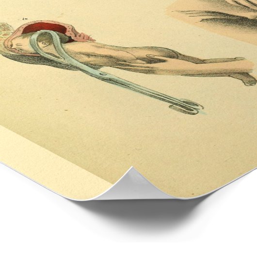 Dijspieren, vochtige forceps, anatomische kunst, a poster (Hoek)