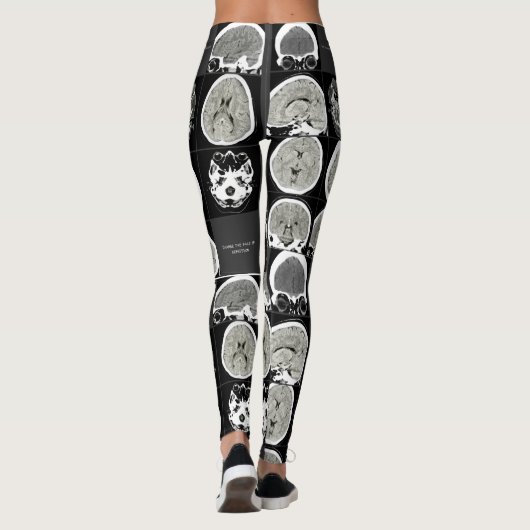 Dit is hoe depressie eruit ziet_CTFOD Leggings (Achterkant)
