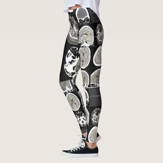 Dit is hoe depressie eruit ziet_CTFOD Leggings (Links)