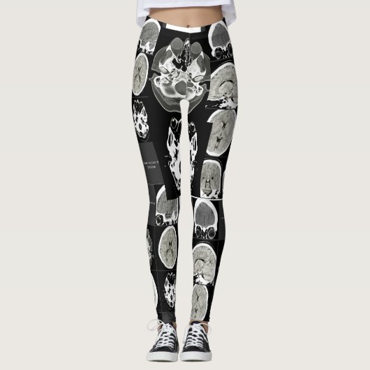 Dit is hoe depressie eruit ziet_CTFOD Leggings (Voorkant)