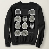 Dit is hoe depressie eruit ziet_FULLCTScan Trui (Design achterkant)