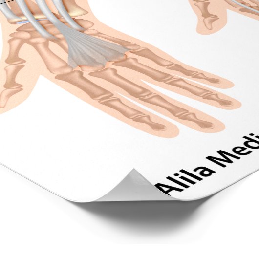 Draaikrankel, met een etiket op tekening. poster (Hoek)