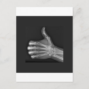 Duimt omhoog briefkaart