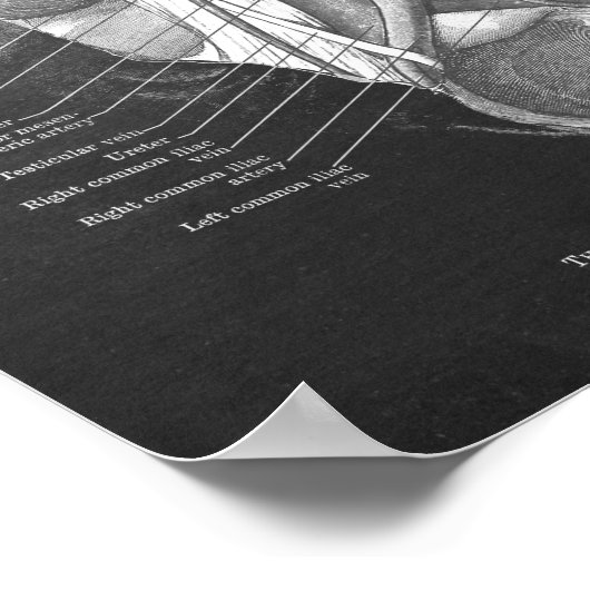 Duodenum Anatomie Kunst Gastroenteroloog Wanddecor Poster (Hoek)