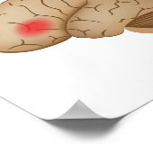 Dyslexie hersenactiviteit Poster (Hoek)