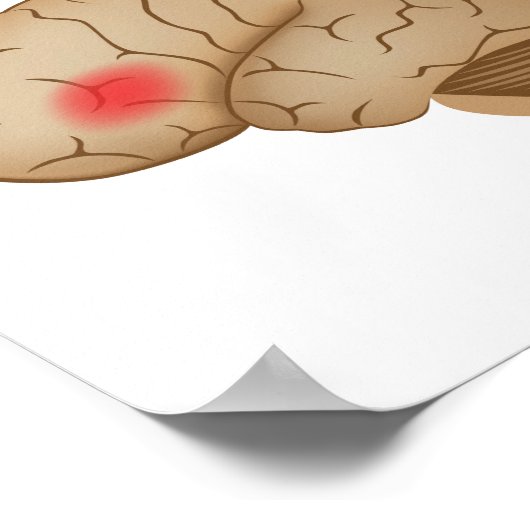 Dyslexie hersenactiviteit Poster (Hoek)