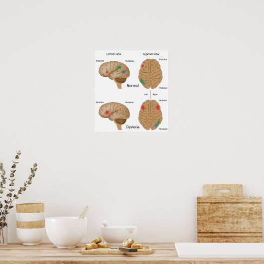 Dyslexie hersenactiviteit Poster (Keuken)