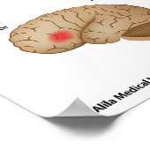 Dyslexie hersenactiviteit Poster (Hoek)