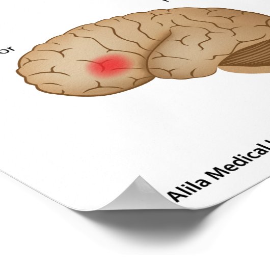 Dyslexie hersenactiviteit Poster (Hoek)