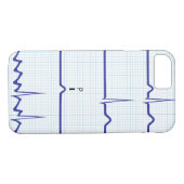 ECG/EKG iPhone case (Achterkant (Horizontaal))