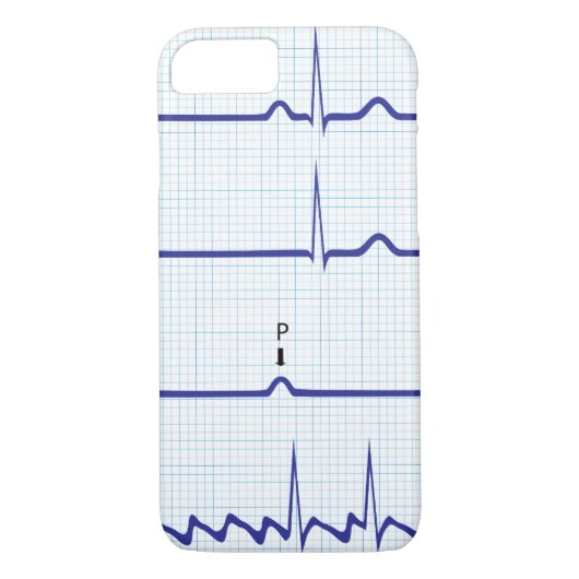 ECG/EKG iPhone case (Achterkant)