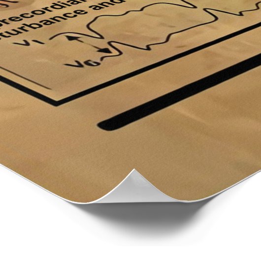 ECG Knowledge Poster, Cardiology Knowledge Poster (Hoek)