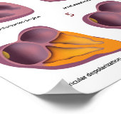 ECG Poster van de elektrische activiteit van het h (Hoek)