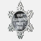 Echografie Afbeelding Custom Sjabloon Tin Sneeuwvlok Ornament (Rechts)