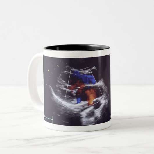 Echografie Foto grootouder om Mok te zijn (Voorkant links)