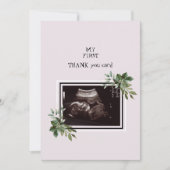 Echografie Foto Roze Baby Punt van Uitzicht Bedankkaart (Voorkant)