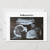 Echografie Pompoen Herfst Letter Board Zwangerscha Aankondiging (Achterkant)