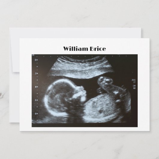 Echografie Pompoen Herfst Letter Board Zwangerscha Aankondiging (Achterkant)