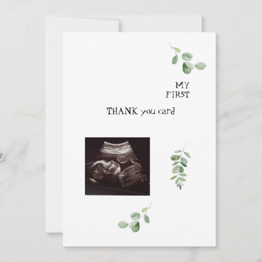 Echografie Wit Dank u Baby Punt van Uitzicht Bedankkaart (Voorkant)