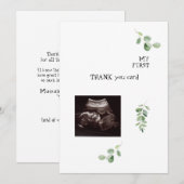 Echografie Wit Dank u Baby Punt van Uitzicht Bedankkaart (Voorkant / Achterkant)