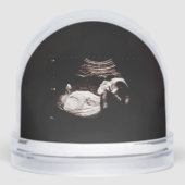 Echografisch Wereldbol Sneeuwbol (Voorkant)