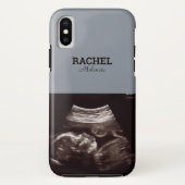 Echografische foto Dusty Blue Monogram Case-Mate iPhone Case (Achterkant)