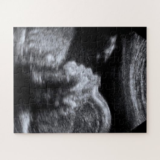 Echografische foto legpuzzel (Horizontaal)