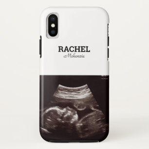 Echografische foto zwart-wit monogram Case-Mate iPhone case