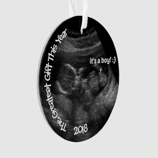 Echografische fotosjabloon AANGEPAST Ornament (voorkant)