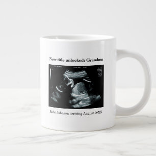 Echoscopie Zwangerschapsaankondiging – Oma worden Grote Koffiekop