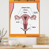 Ectopic Zwangerschap Poster (Keuken)
