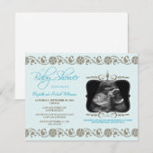 EdelSonogram Baby shower Uitnodiging (blauw) (Voorkant / Achterkant)
