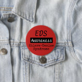 EDS Ehlers-Danlos Syndrome Awareness Zebra Button (In situ)