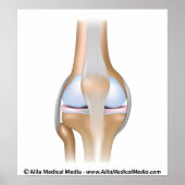 Een anatomiediagram van een kniegewricht zonder la poster (Voorkant)