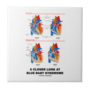 Een blik van dichtbij op blauw Baby syndroom Harta Tegeltje