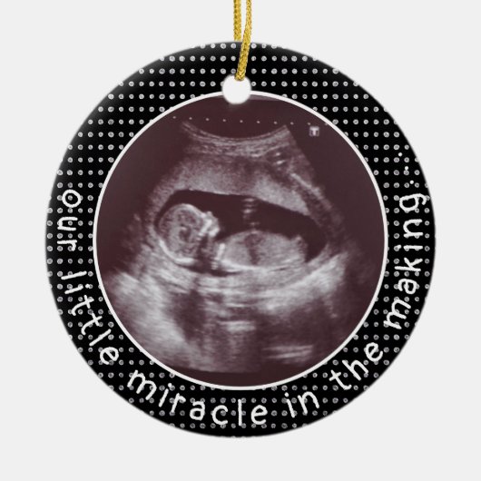 Een klein wonder bij het maken van fotoultrasone S Keramisch Ornament (Voorkant)