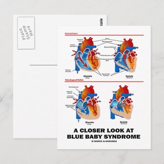Een nadere blik op het Blue Baby-syndroom (hart) Briefkaart (Voorkant / Achterkant)