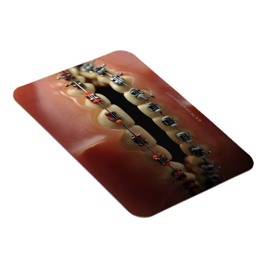 Een tandheelkundig model en de steunen van de Tand Magneet (Rechterzijde)