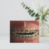 Een tandmodel en de steunen van Tanden Briefkaart (Staand voorkant)