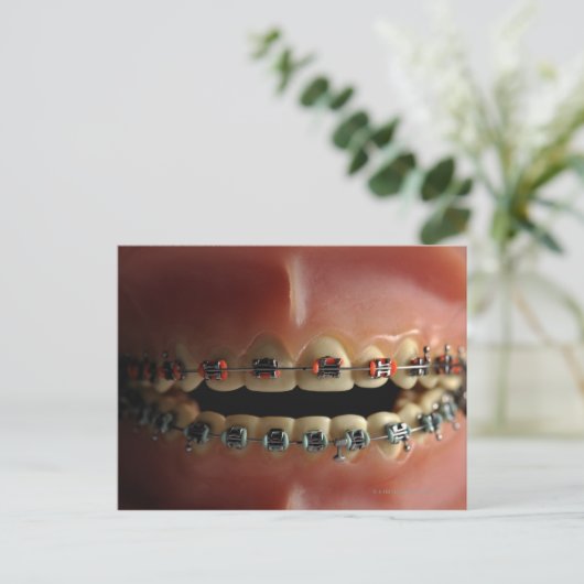 Een tandmodel en de steunen van Tanden Briefkaart (Staand voorkant)