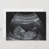 Eenvoudige aankondiging van foto's tijdens zwanger (Achterkant)