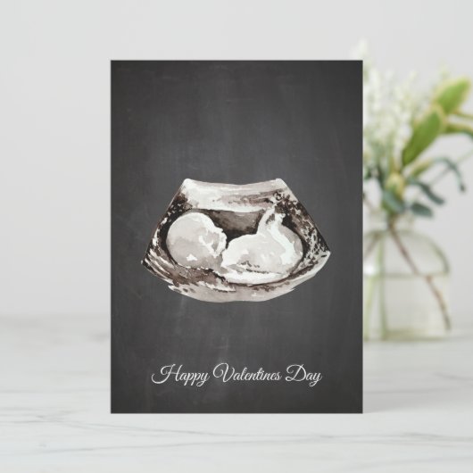 Eenvoudige Baby komt met een fijne Valentijnsdag c Feestdagenkaart (Staand voorkant)