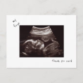 Eenvoudige Grappige Echografie Baby shower Dank u Briefkaart (Voorkant)