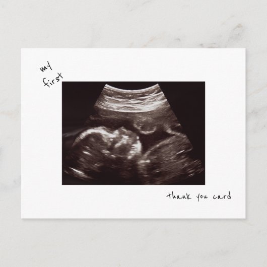 Eenvoudige Grappige Echografie Baby shower Dank u Briefkaart (Voorkant)