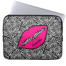 Eenvoudige Zebra met roze lippen gepersonaliseerd