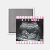 Eerste foto van de baby magneet (Voorkant / Achterkant)