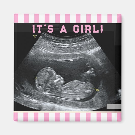 Eerste foto van de baby magneet (Voorkant)